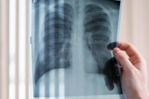 Albertans Can Book MRIs, CT Scans and Other Imaging Without a Doctor’s Referral Starting July 31