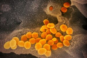 Saskatchewan Reopen Plan Won't Start in Two Communities With COVID-19 Outbreaks