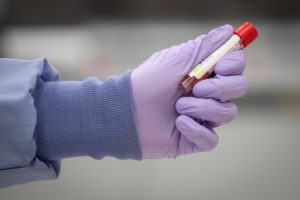 Saskatchewan rolls out benchmark to watch COVID-19 infections during reopen plan